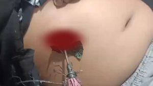 Anak Dibawah Umur Kena Busur di Malino Tinggimoncong